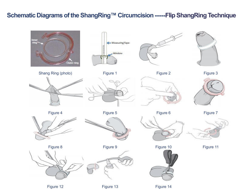 芜湖圣大医疗器械技术股份有限公司+商品说明 5.png