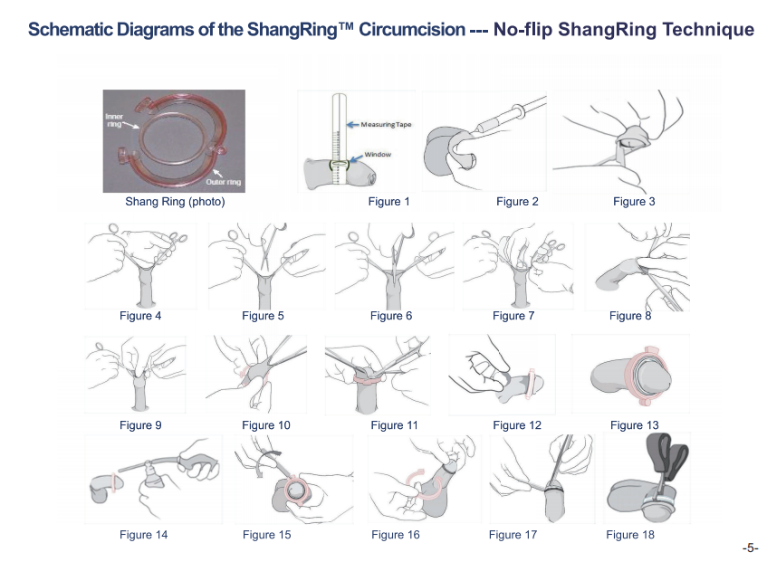 芜湖圣大医疗器械技术股份有限公司+商品说明 6.png